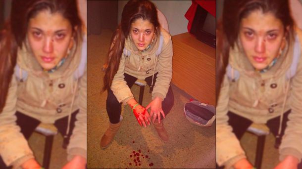 Una joven fue brutalmente golpeada por su novio y su suegra