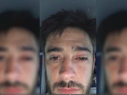 Pablo Pérez, afectado por los gases arrojados en los incidentes