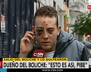 Habló el joven que recibió una brutal golpiza en un boliche: Casi me matan