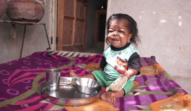 Manpreet tiene 23 años pero parece un bebé de seis meses