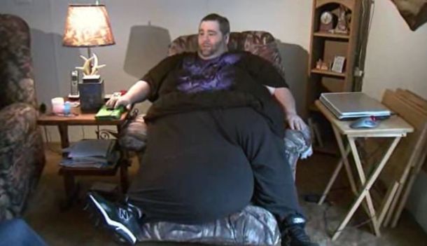 Operación peligrosa: a un hombre le extraerán 45 kilos de los testículos