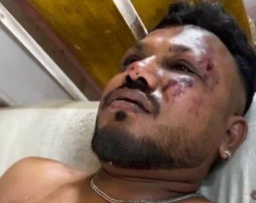 Milagro en la tragedia de Air India: encontraron a un sobreviviente