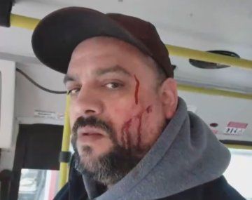 Desfiguraron a un colectivero en Moreno por impedir que viajaran con un certificado trucho