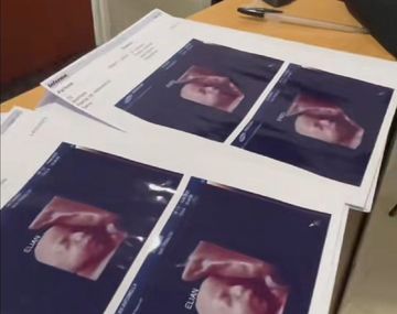 Denuncian que una clínica de ecografías 5D da las mismas fotos a todas las embarazadas