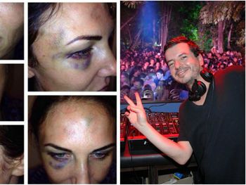 Abigail Blake y Betoko, el DJ que está condenado por golpeador de mujeres