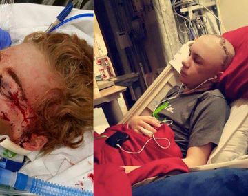 Casi muere por jugar al desafío de la cinta adhesiva