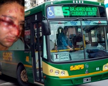 Desfiguraron a un chofer de la línea 85 en Quilmes