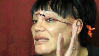 Aldana fue brutalmente atacada. Gentileza: La Nueva Aldana fue brutalmente atacada. Gentileza: La Nueva