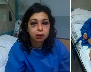 Mujer caminó más de tres horas inconsciente luego de una paliza de su pareja