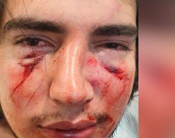 El comunicado de la UAR tras la brutal golpiza de un grupo de rugbiers a un joven en Córdoba