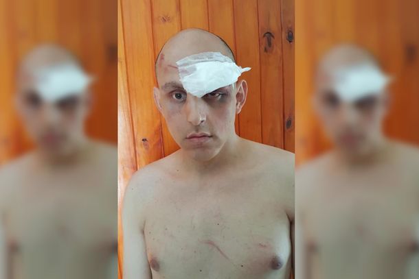 Brutal ataque de patovicas: molieron a golpes a un joven en un boliche por ser gay