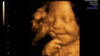 el bebe mas feliz del mundo ya sonreia en la panza de su madre el bebe mas feliz del mundo ya sonreia en la panza de su madre