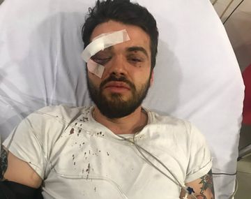 La&nbsp;Comunidad Homosexual Argentina (CHA) indicó que&nbsp;los ataques homofóbicos crecieron un 20 por ciento.