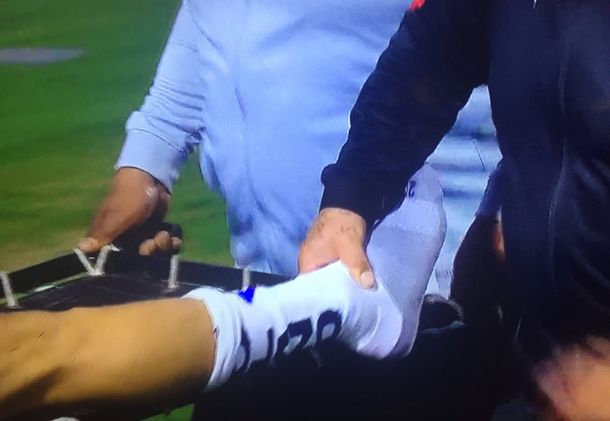 La terrible lesión del jugador de Liga de Quito Christian Cruz