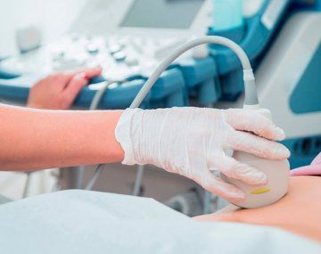 La ANMAT prohibió un ecógrafo y otros productos médicos
