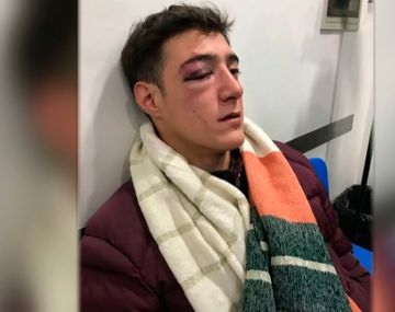 Le dieron un piedrazo en la cara