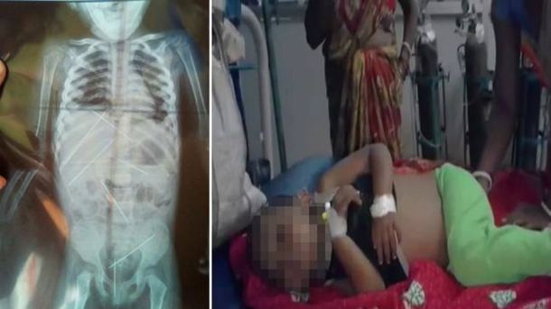 La niña fue abusada sexualmente y usada como muñeca vudú