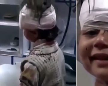 La sonrisa de la nena herida en Alepo