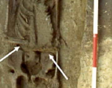 Encuentran los restos más antiguos de un hombre que usaba una prótesis