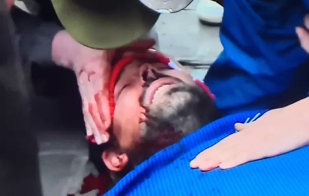 Represión en Recoleta: fue herido el periodista Ezequiel Guazzora