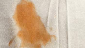 Truco casero: cómo eliminar las manchas amarillas de la ropa Truco casero: cómo eliminar las manchas amarillas de la ropa