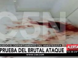 VIDEO: Así quedó el departamento del anestesista tras el brutal ataque