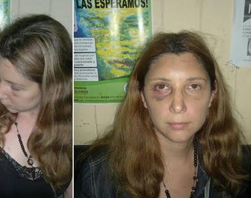 Secuestrada y torturada por su novio