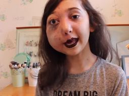 una youtuber de 11 anos inicio una campana por su extrana enfermedad una youtuber de 11 anos inicio una campana por su extrana enfermedad