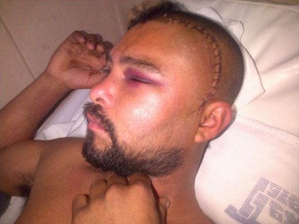 Un hombre perdió el habla luego de sufrir una brutal golpiza a la salida de una fiesta