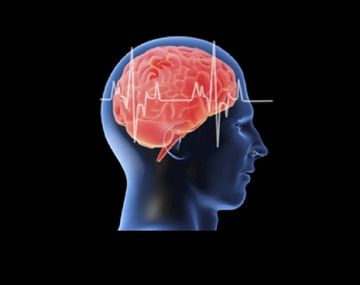 ¿Cómo prevenir un ACV?