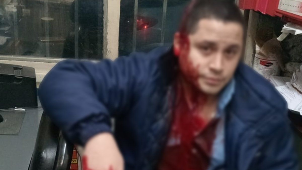 Paro de colectivos en el AMBA por la brutal agresión a un chofer: a qué ...