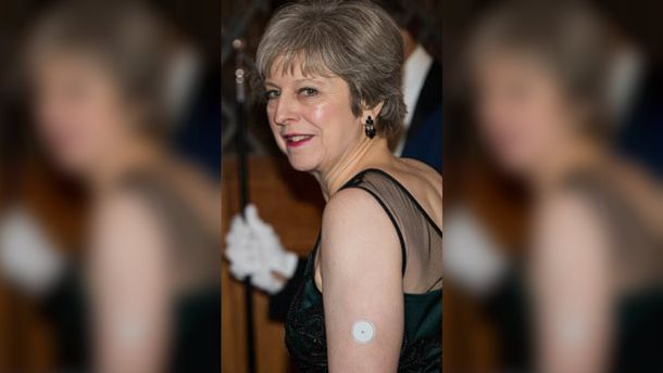 ¿Para qué sirve el botón blanco que Theresa May lleva en la piel?
