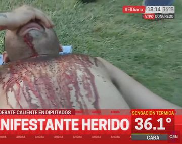 Tensión en el Congreso: un manifestante herido tras la represión policial