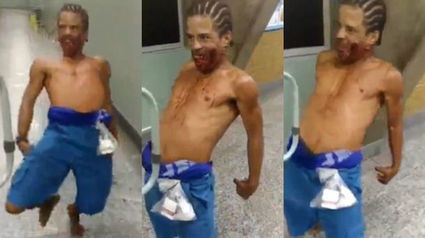 Un hombre que parecía poseído aterrorizó a los pacientes
