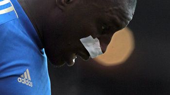 coloccini le rompio la nariz a un ex companero de una patada coloccini le rompio la nariz a un ex companero de una patada