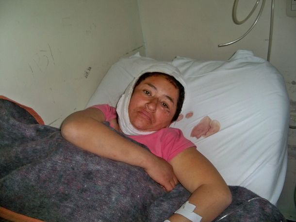 Atacó a su mujer a martillazos porque se quería separar
