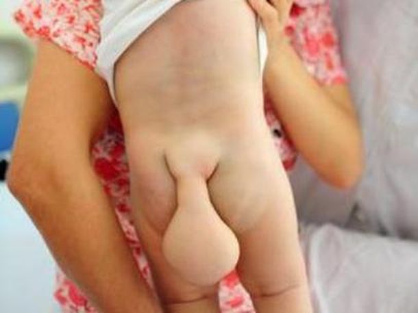 Conmoción por un bebe chino que tiene una cola de castor