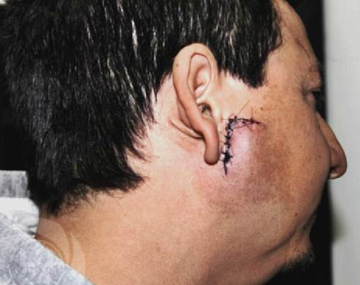 Le piropearon a la mujer y los agarró a tablazos