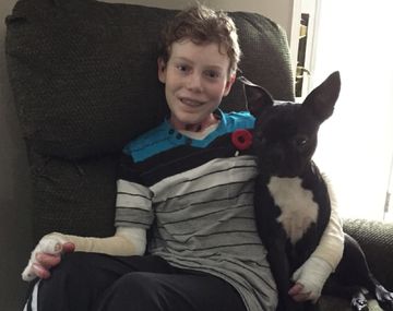 Conocé la dramática historia del chico con piel de mariposa