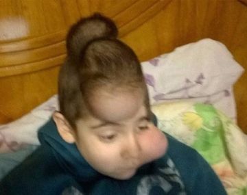 Franco tiene 7 años y necesita una operación para salvar su vida