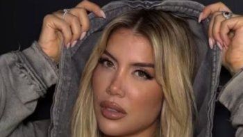 wanda nara consulto a sus seguidores antes de someterse a un nuevo retoque estetico wanda nara consulto a sus seguidores antes de someterse a un nuevo retoque estetico