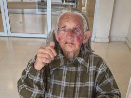 Virrey del Pino: salvaje ataque a una anciana durante un robo