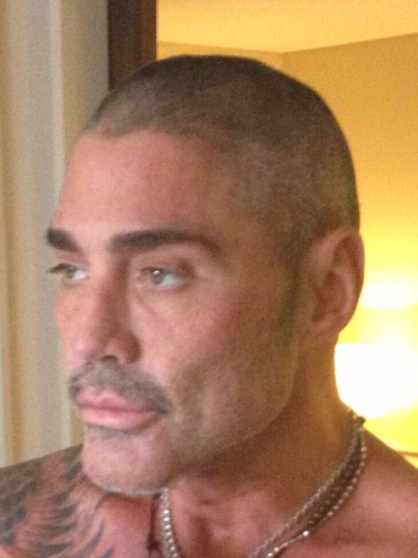 Ricardo Fort volverá a pasar por el quirófano