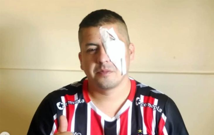 Jonathan Leandro Navarro, víctima de la represión en Congreso.