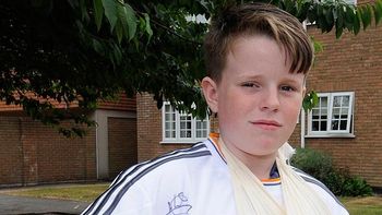 cr7 le fracturo la muneca a un nene de un pelotazo cr7 le fracturo la muneca a un nene de un pelotazo