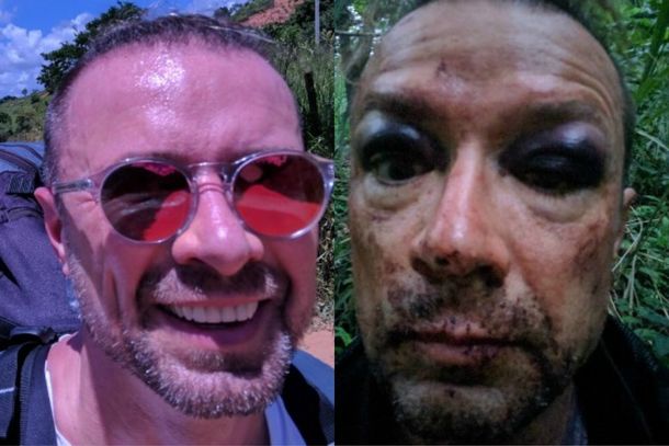 Sufrió un accidente