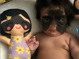 Una bebé se convirtió en estrella de Instagram con su marca de nacimiento