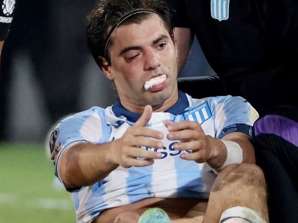 Santiago Sosa sufrió una fractura tras el golpe con Marcos Rojo en Flamengo vs. Racing