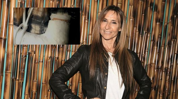 Gladys Florimonte: Me quebré la muñeca y el dedo