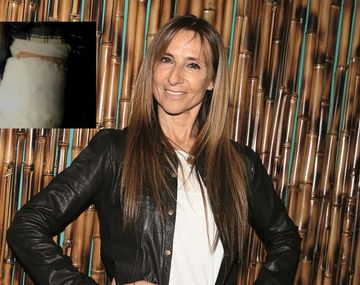 Gladys Florimonte: Me quebré la muñeca y el dedo